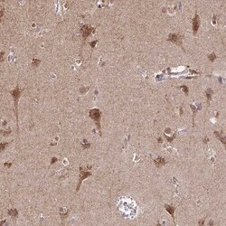 TIMM50 Antibody, Novus Biologicals 0.1mL; Unlabeled:Antibodies, Polyclonal